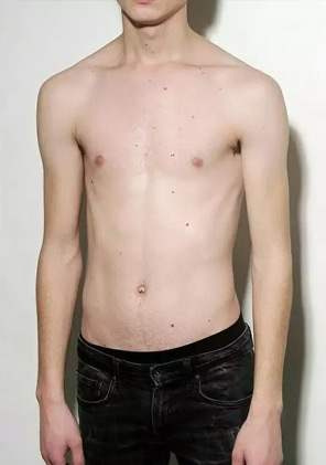 Gain